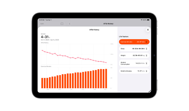 心房顫動記錄及運動記錄