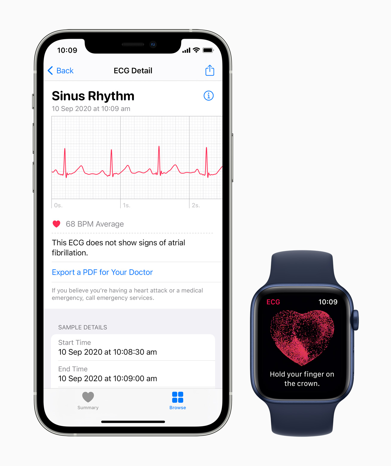 ecg-app-and-irregular-rhythm-notification-now-available-on-apple-watch