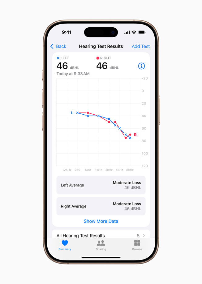 Un iPhone 16 Pro affiche les résultats d’un Test d’audition sous forme de graphique.