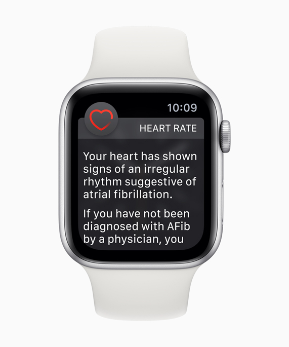 ECG app and irregular heart rhythm 