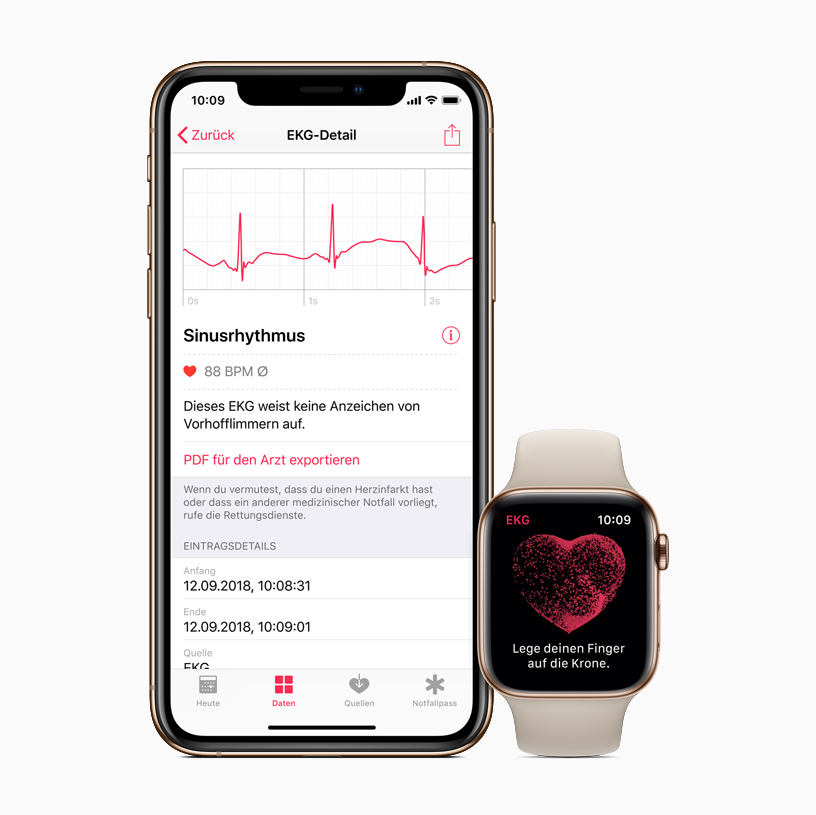 iPhone and Apple Watch showing ECG app.