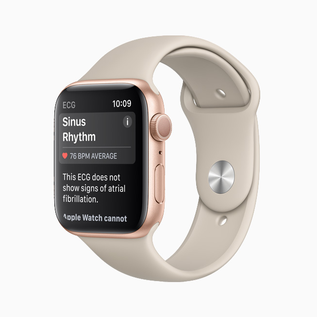 Sinus Rhythm notification displayed in the ECG app on Apple Watch.