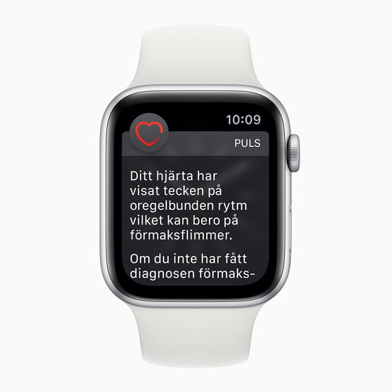Apple Watch-urtavla med notis om oregelbunden hjärtrytm.