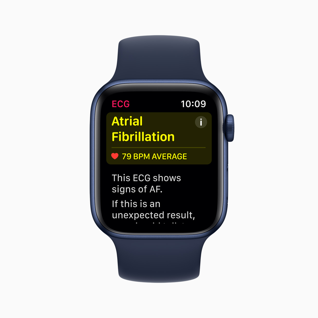 ecg-app-and-irregular-rhythm-notification-now-available-on-apple-watch